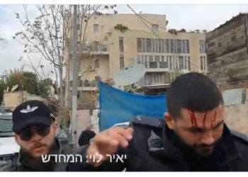 Un policier blessé par des émeutiers arabes dans le quartier de Shimon HaTzadik