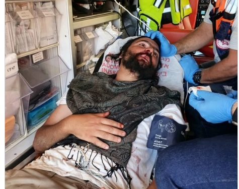 Une foule arabe a blessé un homme juif et tué son chien en Samarie