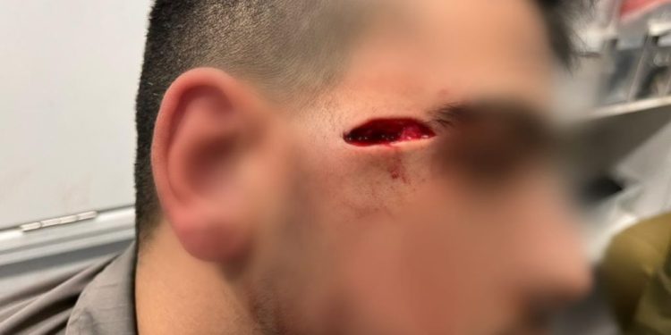 Arabe éliminé en tentant de voler l’arme d’un policier israélien après en avoir blessé un autre : l’ONU et l’UE condamnent Israël