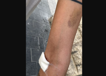 Une femme arabe brutalement battue à Jérusalem par des Arabes, qui l&rsquo;on pris pour une juive