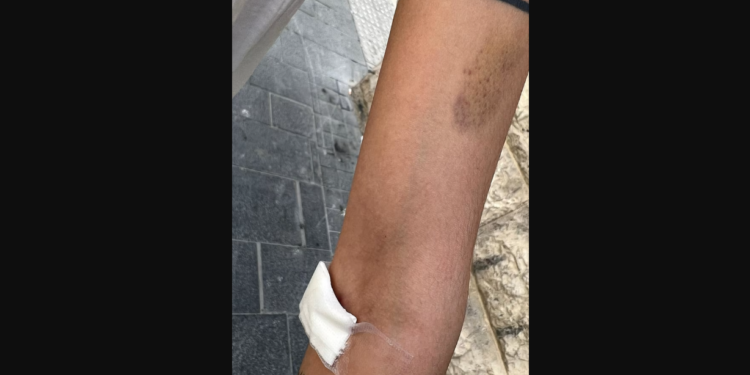 Une femme arabe brutalement battue à Jérusalem par des Arabes, qui l’on pris pour une juive