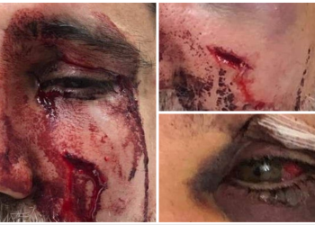 Horrible : un loubavitch massacré, sans autre raison que d’être juif, par les gauchistes