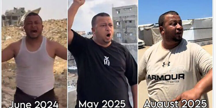 Vlan ! Un rapport de l’ONU montre que les Gazaouis sont plus en surpoids que les Israéliens